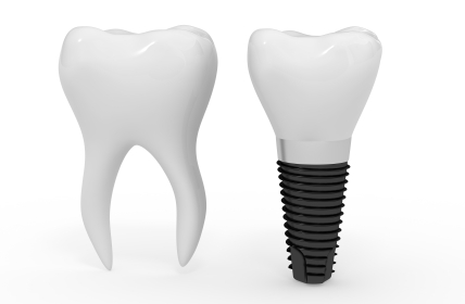 Image of a molar side by side. 