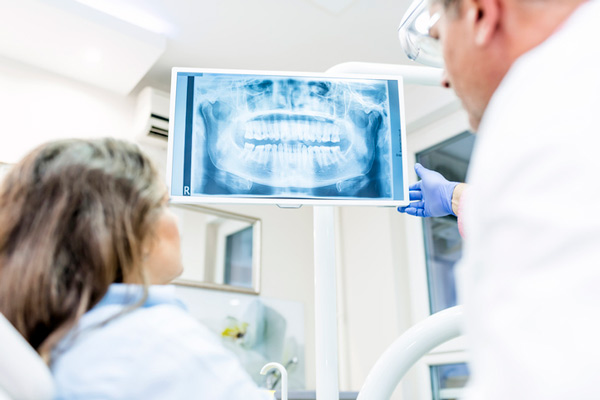 Dentist explaining digital x-ray to a woman in dental chair, at Fusion Dental Specialists in Happy Valley, OR.